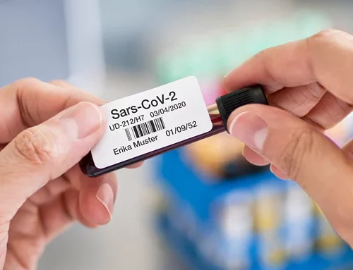 Corona-Tests: So gelingt die effiziente Beschriftung von Proben mit Brother Etikettendruckern